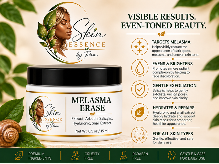 Melasma Erase
